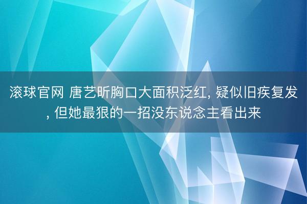 滚球官网 唐艺昕胸口大面积泛红, 疑似旧疾复发, 但她最狠的一招没东说念主看出来